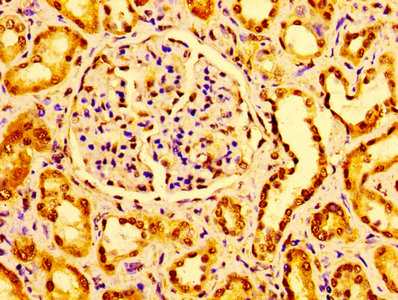 Immunoprecipitating GM2A in HEK293 whole cell lysate; , Lane 1: Rabbit control IgG instead in HEK293 whole cell lysate. For western blotting, a HRP-conjugated Protein G antibody was used as the secondary antibody (1/2000); , Lane 2: CAC10387 (8µg) + HEK293 whole cell lysate (500µg); , Lane 3: HEK293 whole cell lysate (10µg)
