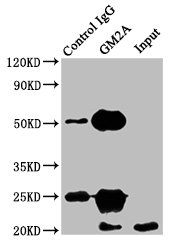 Gm2A Polyclonal Antibody - image 5