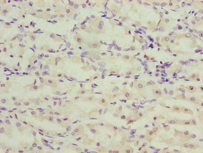 Tmem71 Polyclonal Antibody - image 4