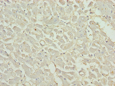 Immunohistochemistry of paraffin-embedded human skeletal muscle tissue using CAC10400 at dilution of 1:100