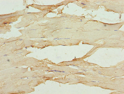 Mb Polyclonal Antibody - image 4