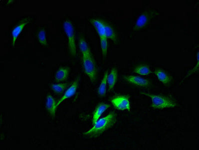 Ambp Polyclonal Antibody - image 2