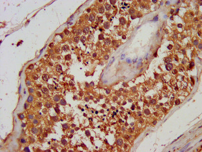 Tg Polyclonal Antibody - image 2