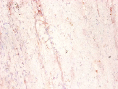 Map1S Polyclonal Antibody - image 2