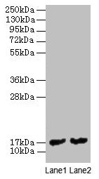 Mpt63 Polyclonal Antibody - image 2