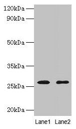 Immunohistochemistry of paraffin-embedded human kidney tissue using CAC10447 at dilution of 1:100