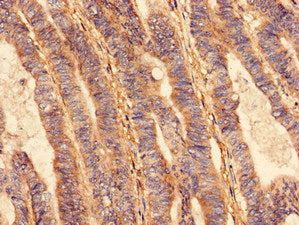 Immunofluorescent analysis of PC-3 cells using CAC10453 at dilution of 1:100 and Alexa Fluor 488-congugated AffiniPure Goat Anti-Rabbit IgG(H+L)