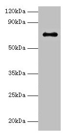 Immunohistochemistry of paraffin-embedded human testis tissue using CAC10471 at dilution of 1:100