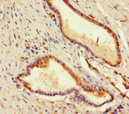 Adck2 Polyclonal Antibody - image 4