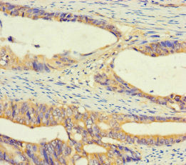 Ugt2A3 Polyclonal Antibody - image 3