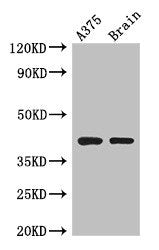 Immunofluorescent analysis of U251 cells using CAC10482 at dilution of 1:100 and Alexa Fluor 488-congugated AffiniPure Goat Anti-Rabbit IgG(H+L)