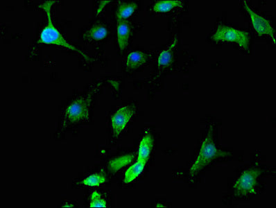 45181 Polyclonal Antibody - image 3