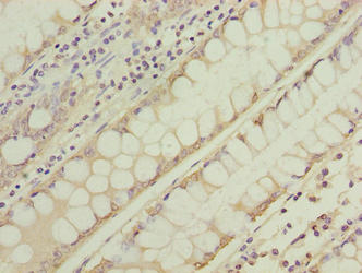 Nsun7 Polyclonal Antibody - image 3