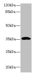 Immunohistochemistry of paraffin-embedded human skin tissue using CAC10501 at dilution of 1:100