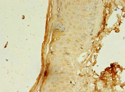 Ccdc24 Polyclonal Antibody - image 3