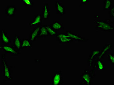 Strbp Polyclonal Antibody - image 3
