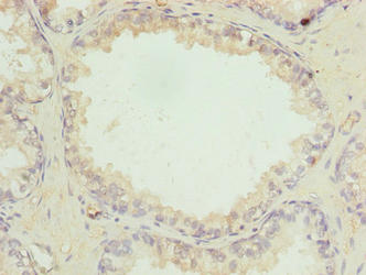 Immunohistochemistry of paraffin-embedded human kidney tissue using CAC10520 at dilution of 1:100