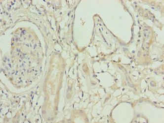 Acsbg1 Polyclonal Antibody - image 3
