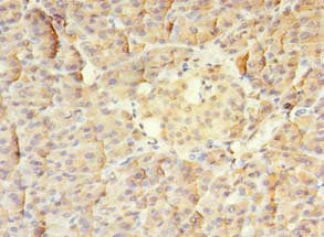Immunoprecipitating MTR in Hela whole cell lysate; , Lane 1: Rabbit control IgG instead in Hela whole cell lysate. For western blotting, a HRP-conjugated Protein G antibody was used as the secondary antibody (1/2000); , Lane 2: CAC10527 (8µg) + Hela whole cell lysate (500µg); , Lane 3: Hela whole cell lysate (10µg)
