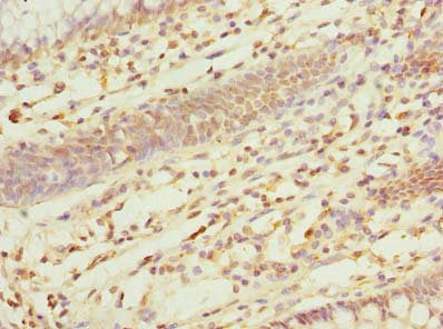 Immunohistochemistry of paraffin-embedded human lung tissue using CAC10528 at dilution of 1:100
