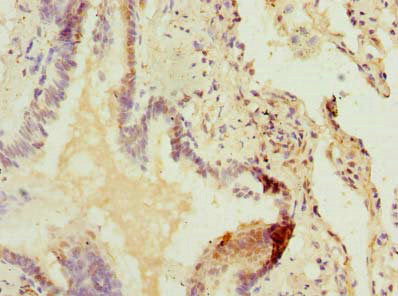 Immunofluorescent analysis of 293T cells using CAC10528 at dilution of 1:100 and Alexa Fluor 488-congugated AffiniPure Goat Anti-Rabbit IgG(H+L)