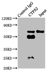 Western Blot; ,Positive WB detected in: HepG2 whole cell lysate; ,All lanes: CTPS2 antibody at 2.8µg/ml; ,Secondary; ,Goat polyclonal to rabbit IgG at 1/50000 dilution; ,Predicted band size: 66 kDa; ,Observed band size: 66 kDa