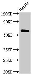 Immunocytochemistry analysis of human gastric cancer using CAC10529 at dilution of 1:100