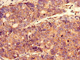 Immunocytochemistry analysis of human prostate tissue using CAC10529 at dilution of 1:100