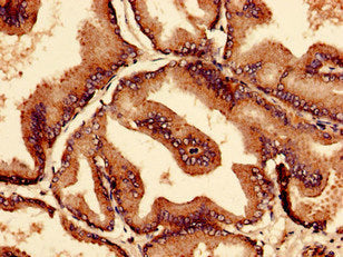 Ctps2 Polyclonal Antibody - image 5