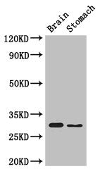 Immunohistochemistry of paraffin-embedded human testis tissue using CAC10536 at dilution of 1:100