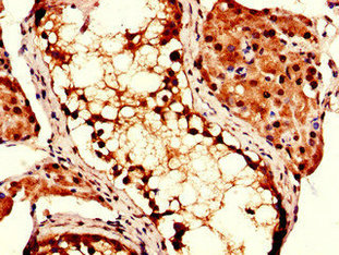 Immunofluorescent analysis of Hela cells using CAC10536 at dilution of 1:100 and Alexa Fluor 488-congugated AffiniPure Goat Anti-Rabbit IgG(H+L)