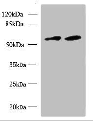 Immunohistochemistry of paraffin-embedded human testis tissue using CAC10542 at dilution of 1:100