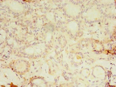 Kbtbd4 Polyclonal Antibody - image 4
