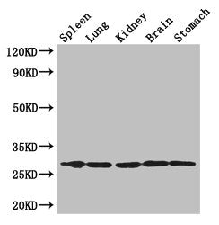 Immunohistochemistry of paraffin-embedded human kidney tissue using CAC10546 at dilution of 1:100