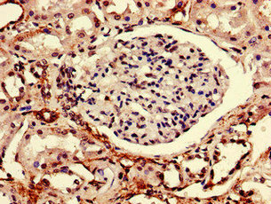 Immunoprecipitating RTP3 in Mouse brain tissue; , Lane 1: Rabbit control IgG (1µg) instead in Mouse brain tissue. For western blotting, a HRP-conjugated light chain specific antibody was used as the secondary antibody (1/50000); , Lane 2: CAC10546 (8µg) + Mouse brain tissue (500µg); , Lane 3: Mouse brain tissue (10µg)