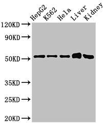 Immunohistochemistry of paraffin-embedded human skeletal muscle tissue using CAC10551 at dilution of 1:100