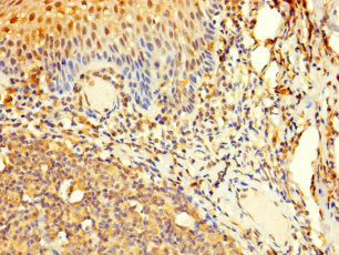 Aar2 Polyclonal Antibody - image 2