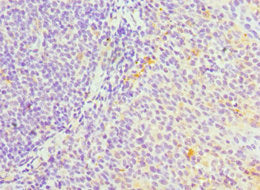 Immunohistochemistry of paraffin-embedded human testis tissue using CAC10563 at dilution of 1:100