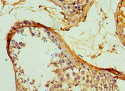 Serpinh1 Polyclonal Antibody - image 4