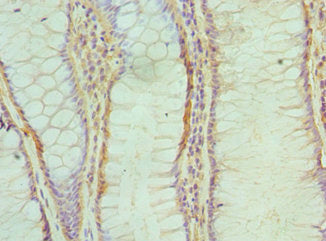 Alkbh1 Polyclonal Antibody - image 3