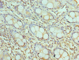 Aktip Polyclonal Antibody - image 2