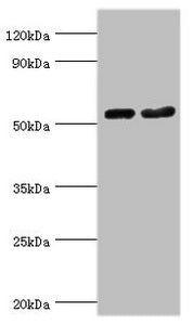 Immunohistochemistry of paraffin-embedded human brain tissue using CAC10573 at dilution of 1:100
