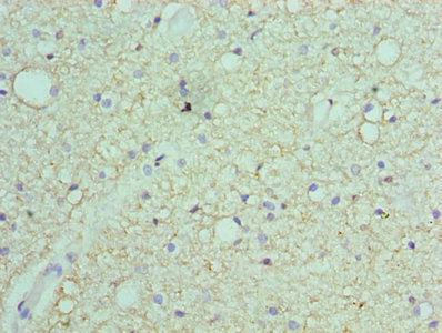 45176 Polyclonal Antibody - image 3