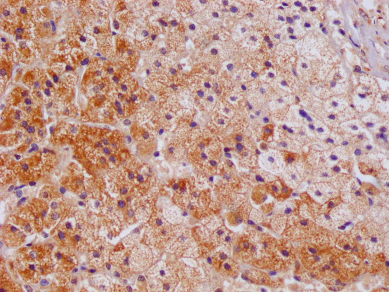Amhr2 Polyclonal Antibody - image 3