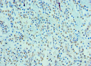 Cry2 Polyclonal Antibody - image 3