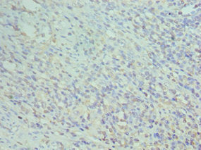 Immunoprecipitating CD74 in Raji whole cell lysate; ,Lane 1: Rabbit control IgG instead in Raji whole cell lysate. For western blotting, a HRP-conjugated Protein G antibody was used as the secondary antibody (1/2000); ,Lane 2: CAC10589 (8µg) + Raji whole cell lysate (500µg); ,Lane 3: Raji whole cell lysate (10µg)