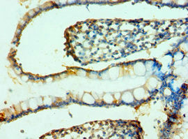 Immunohistochemistry of paraffin-embedded human skin tissue using CAC10591 at dilution of 1:100