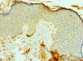 Fap Polyclonal Antibody - image 3
