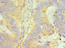 Immunohistochemistry of paraffin-embedded human placenta tissue using CAC10595 at dilution of 1:100