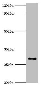Immunohistochemistry of paraffin-embedded human small intestine tissue using CAC10618 at dilution of 1:100